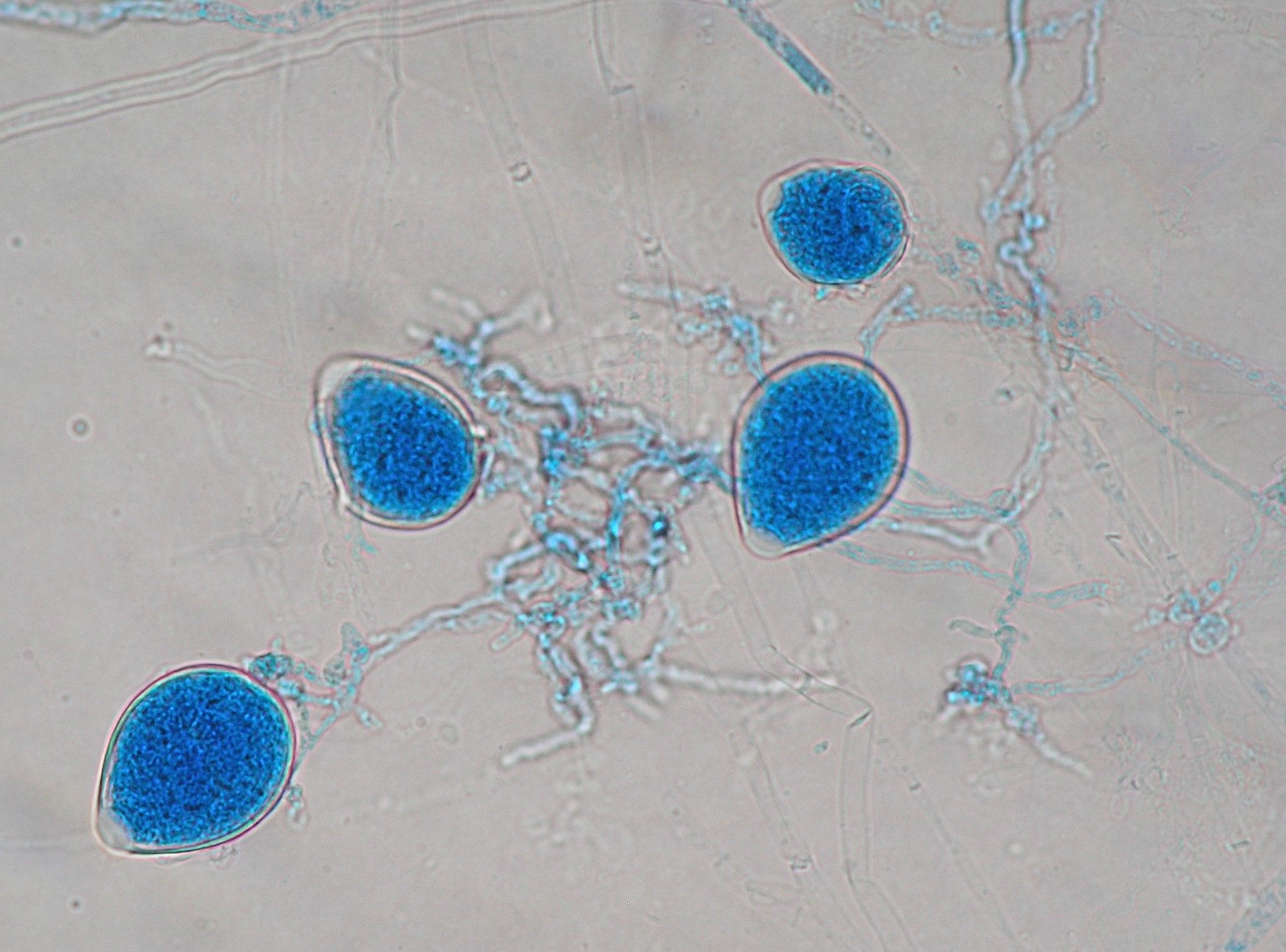 Esporangios Phytophthora